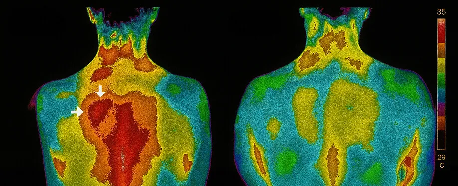 Thermal Imaging Comparison